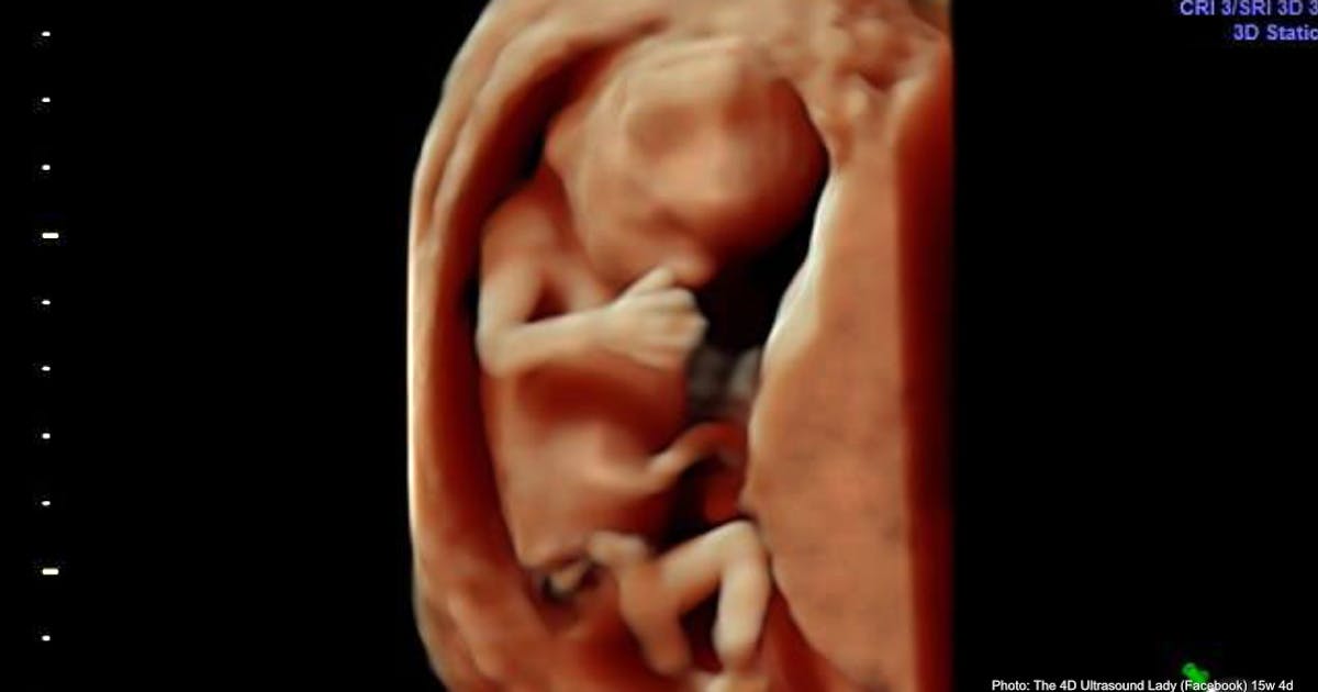 Gallup poll: American attitudes on abortion remain largely unchanged