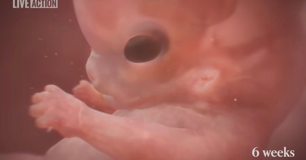 Prenatal development in Baby Olivia mirrors markers in abortion training source