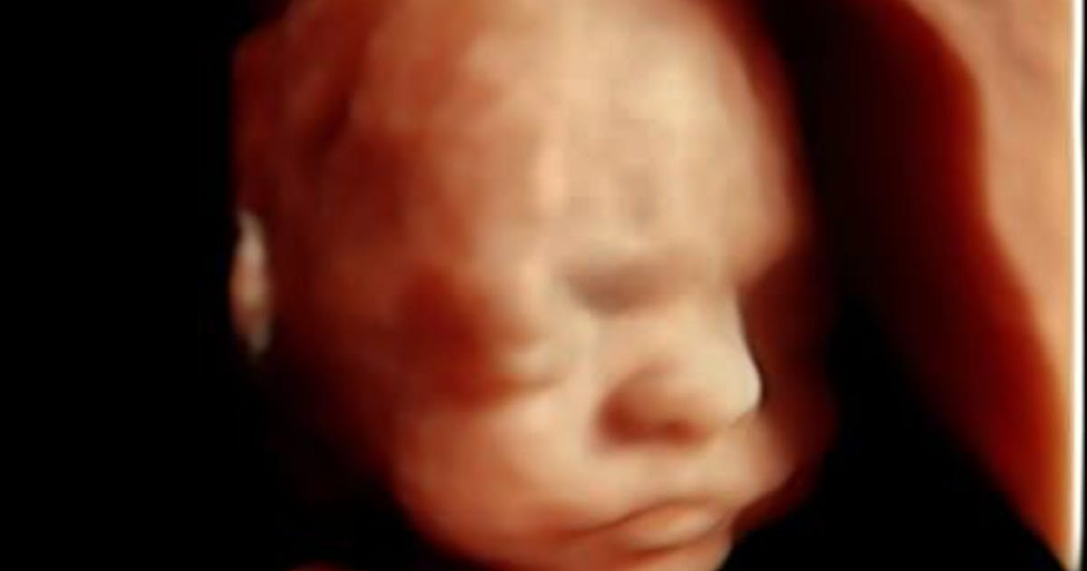 South Australia lawmakers refuse to close late-term abortion loophole