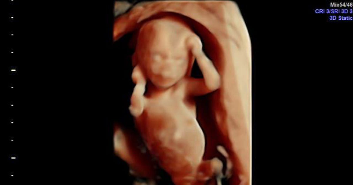Malta court dismisses case that sought to end country's pro-life laws