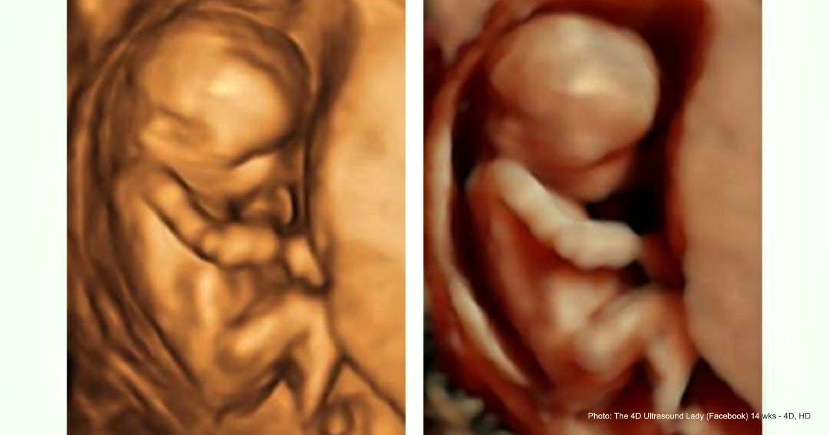 Pro-abortion groups rage as Madrid enacts family benefits that include preborn children