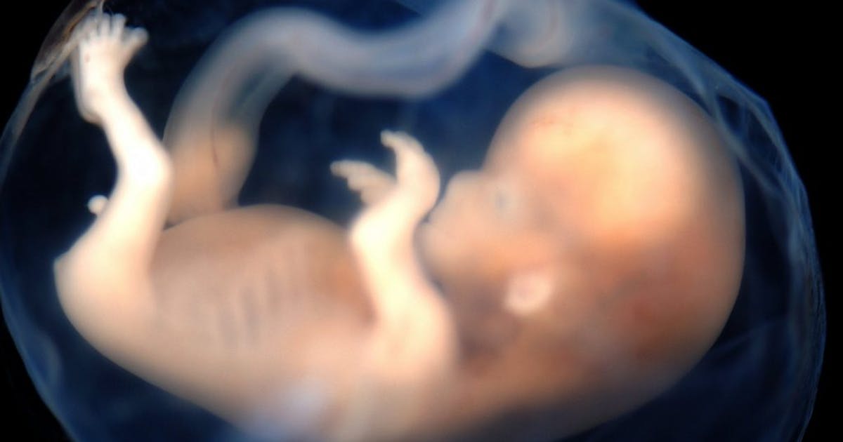 Dominica High Court decriminalizes abortion in some circumstances