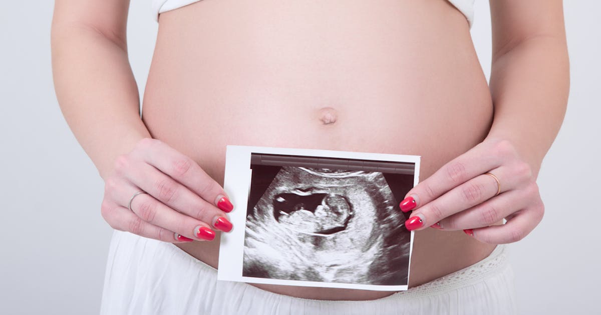 Bill introduced in Chile requires abortion seekers to hear child's heartbeat