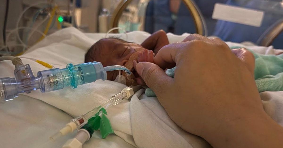 Micropreemie beats the odds after spending 123 days in the NICU