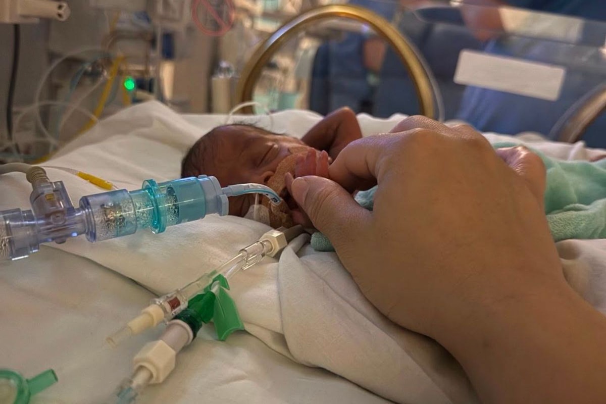 Micropreemie beats the odds after spending 123 days in the NICU