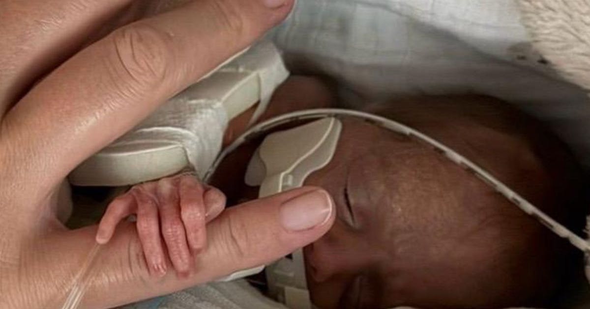 Paralympian welcomes premature baby after experiencing complications