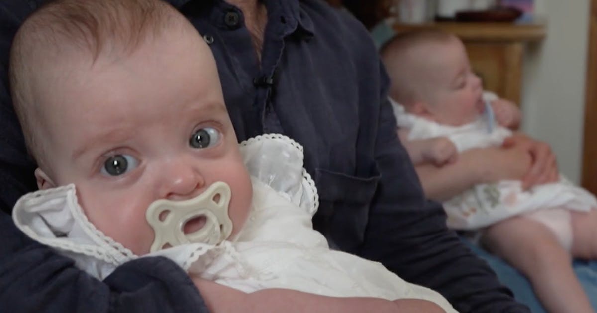 After refusing abortion, parents name daughter after doctor who saved twins' lives