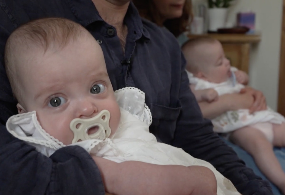 After refusing abortion, parents name daughter after doctor who saved twins' lives