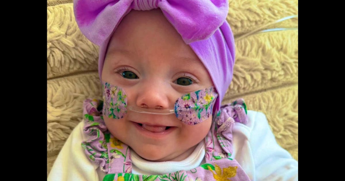 Parents launch new business inspired by their premature daughter