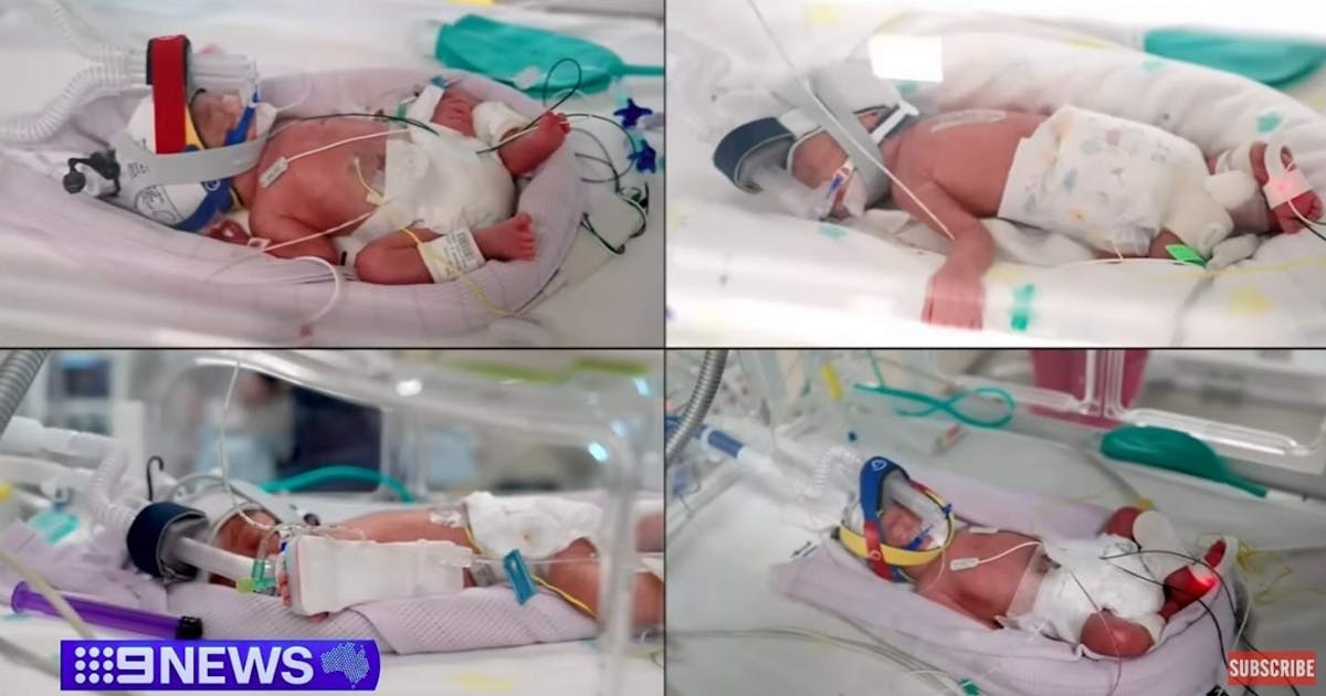 Mom safely gives birth to rare identical quadruplets in 'very, very high risk' pregnancy
