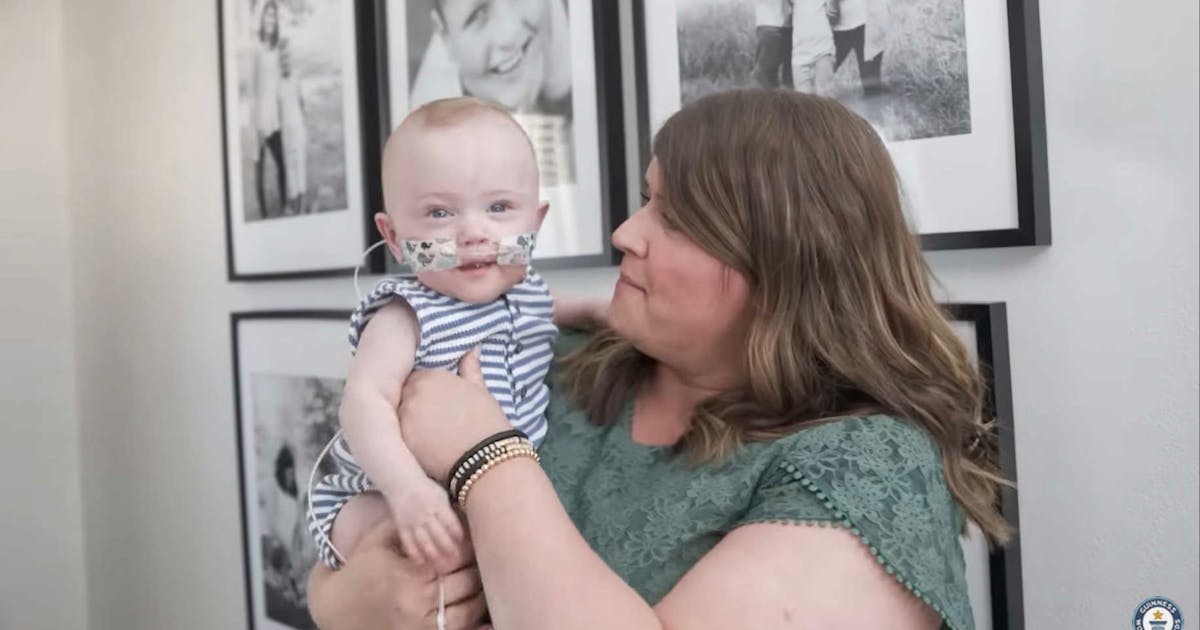 Guinness World Record holder for most premature surviving baby turns two
