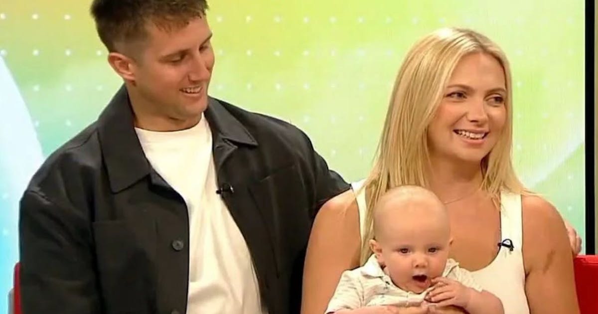 Baby who had in-utero surgery for gastroschisis is now thriving