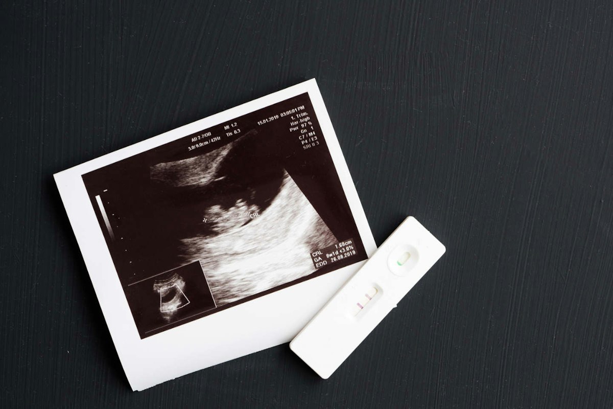 She became pregnant after years of trying... and promptly aborted her baby