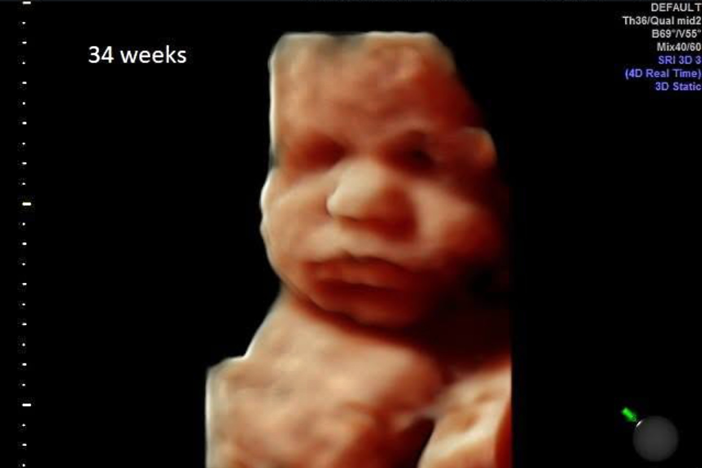 SCAM: Abortionists lethally inject babies, then send moms to hospitals for 'stillbirths'