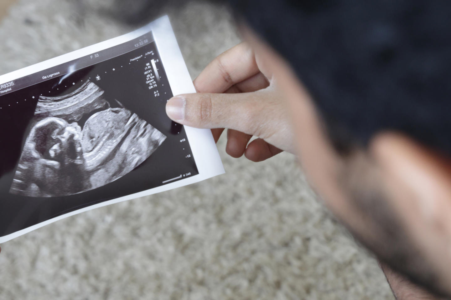 Court awards grieving father damages after losing child to abortion