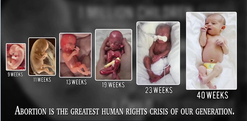 ABortion-human-rights-late-term-Live-Action.jpg