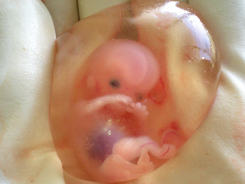 preborn, first trimester
