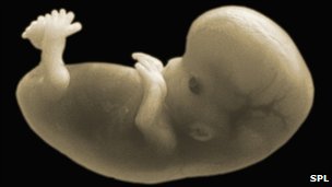 An unborn baby, very early on in pregnancy.