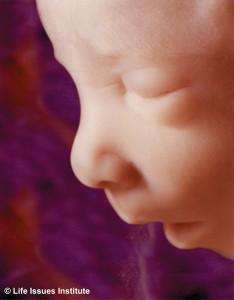 16-weeks-human-fetus