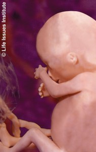 16-weeks-human-fetus2