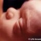 abortions,abortion, late-term, aborted, baby olivia, viability