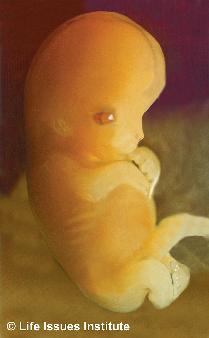 Unborn baby, 7 weeks after conception