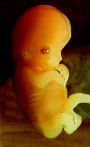 He can be killed on demand; this is not compromise. (Human fetus at 7 weeks of development.)