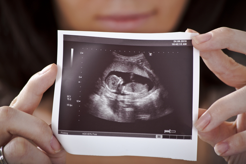 preborn, pregnancy resource centers, ultrasound