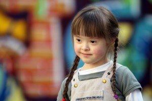 h down syndrome