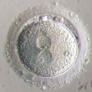 Zygote-image