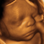 3d-ultrasound-fetus-baby1