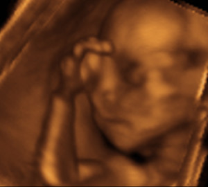 3d-ultrasound-fetus-baby3