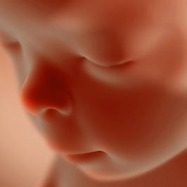 20 week old unborn child - when many states still allow abortion