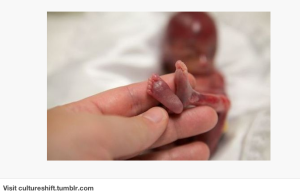 A beautiful, valuable, miscarried baby.