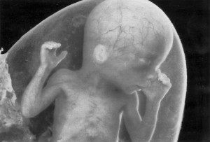 A developing unborn child