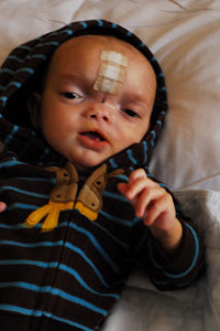 Dominic Pio after surgery.
