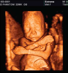 Protecting him? Not pro-life, apparently