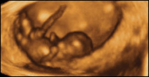 "At 8 weeks, this baby can kick and straighten his legs, and move his arms up and down." This and other incredible 4D ultrasound photos can be found here - copyright of Life Dynamics.