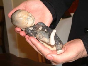 This baby was aborted by the saline abortion method. picture provided by Priests For Life