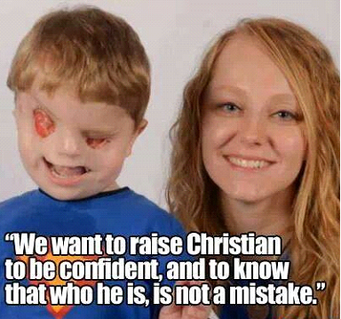 Christian Buchanan with his mother Lacey. He wasn't a typical newborn, but he has always been equally valuable. Christian's story has gone viral, thanks to a YouTube video his mother made.