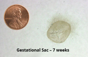 g-sac-7-weeks