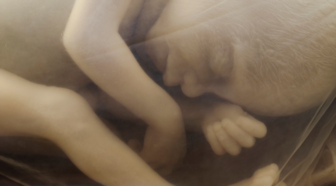 human-fetus-20-weeks, pro-life, abortion restrictions