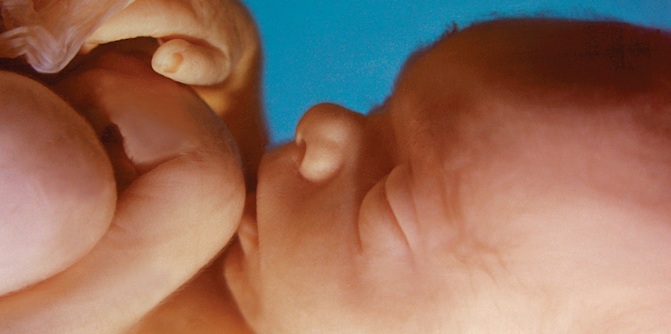 preborn baby, babies, Illinois, aborted, abortion, abortionist, Planned Parenthood
