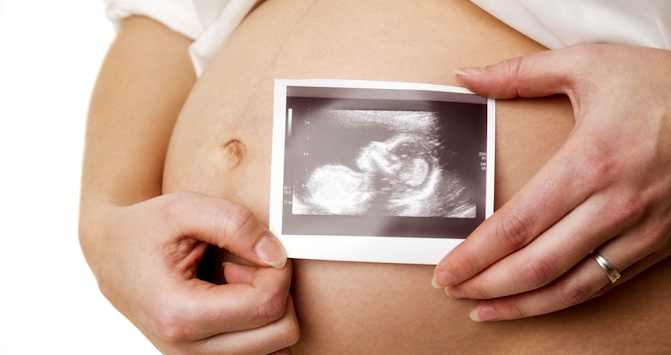 miscarriage, ultrasound, abortion