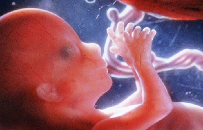 abortions, D&E, preborn, how abortion works, pro-life, abortion, Preborn human at about 16 weeks - estimated time of the attempted abortion of Elisa.