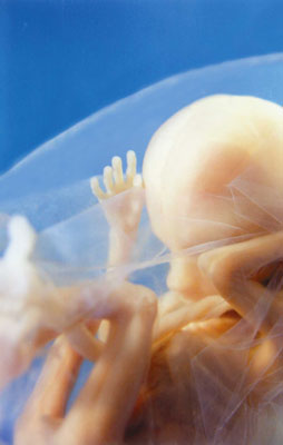 A preborn child at 14 weeks, just before the protection in Mississippi would take effect.