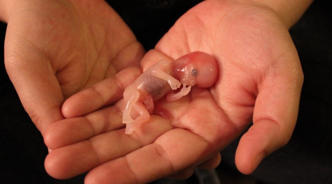 Stunning photo of Noah, miscarried at 12 weeks, will amaze you