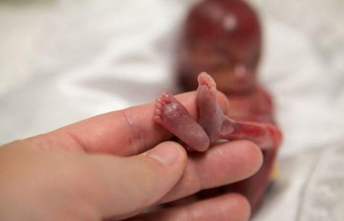 Miscarried at 19 weeks, baby Walter’s life is changing the abortion debate