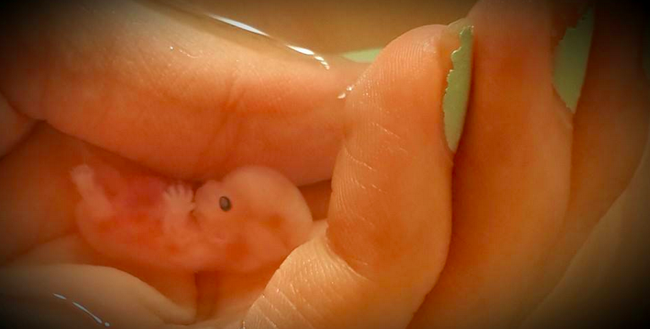 Annabelle, 8 weeks 5 days, fetus, baby, embryo