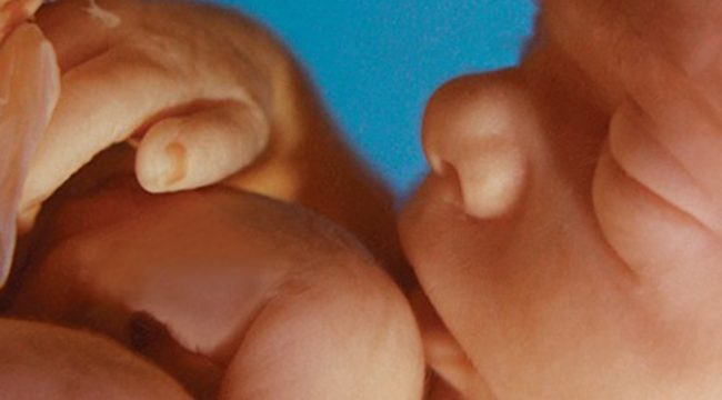 unborn-human-fetus